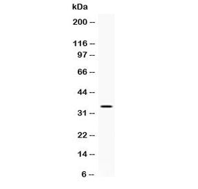 Western blot testing of human A431 cell lysate with NAT1 antibody at 0.5ug/ml. Predicted molecular w