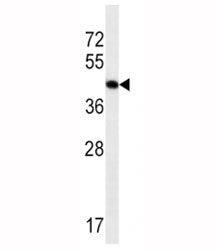 Actin Antibody (alpha)