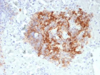 IHC staining of FFPE human lymph node with CD35 antibody (clone CR1/6380) at 2ug/ml. HIER: boil tiss