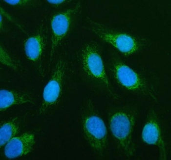 Immunofluorescent staining of FFPE human U-2 OS cells with ACADVL antibody (green) and DAPI nuclear 