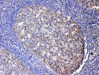 IHC testing of FFPE human tonsil tissue with IL-13 antibody at 1ug/ml. Required HIER: steam section 