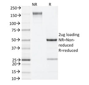 SDS-PAGE analysis of purified, BSA-free IL-4 antibody (clone 11B11) as confirmation of integrity and