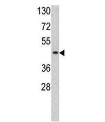 TBP Antibody (TATA Binding Protein)