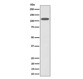 ZHX2 Antibody / Zinc fingers and homeoboxes protein 2