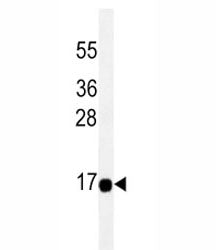 THEM2 Antibody, 0.08ml
