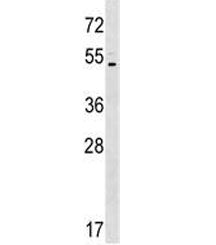 Western blot testing of human K562 lysate with ASIC5 antibody at 1:500. Predicted molecular weight ~57 kDa.