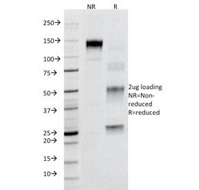 SDS-PAGE Analysis of Purified, BSA-Free Fas Antibody (B-R18). Confirmation of Integrity and Purity o