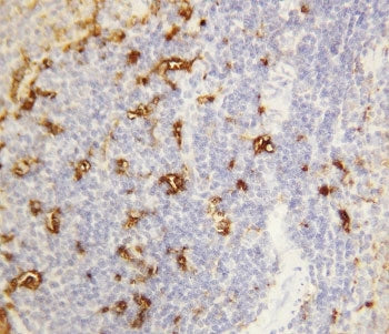 Alpha Amylase 1 Antibody
