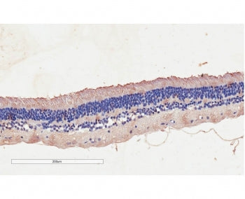 CNGB3 Antibody