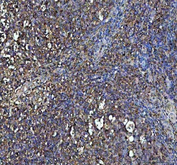 IHC staining of FFPE human tonsil tissue with IFNG antibody. HIER: boil tissue sections in pH8 EDTA 