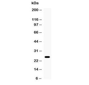 TNF alpha Antibody