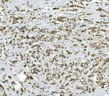 PRDM5 Antibody
