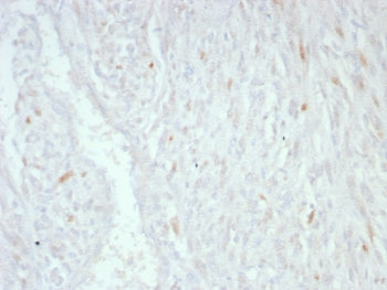 MDM2 Antibody