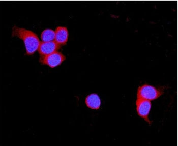Immunofluorescent staining of FFPE human MCF7 cells with TNXB antibody (red) and DAPI nuclear stain 