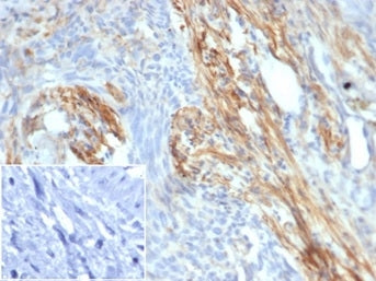 PI3K Antibody (p85 beta) / PIK3R2