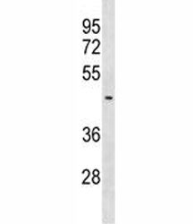 SUV39H2 Antibody (KTM1B)