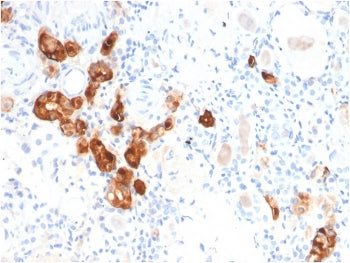Calbindin Antibody / CALB1
