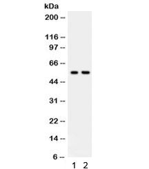 Western blot testing of human 1) HeLa and 2) Jurkat lysate with TRAF2 antibody. Predicted/expected m