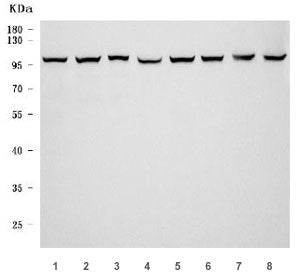 Western blot testing of 1) rat brain, 2) rat lung, 3) rat stomach, 4) rat C6, 5) mouse brain, 6) mou