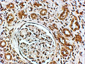IHC testing of FFPE human kidney with VSP41 antibody at 4ug/ml. HIER: steamed with pH6 citrate buffe