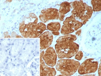 FABP1 Antibody / Fatty Acid Binding Protein 1