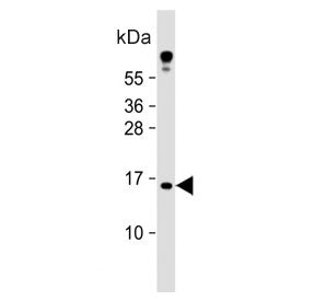 Tumor suppressor ARF Antibody / CDKN2A / MLM