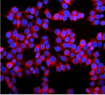 Immunofluorescent staining of FFPE human MCF-7 cells with Stathmin 1 antibody (red) and DAPI nuclear