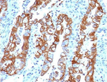 TROP2 Antibody