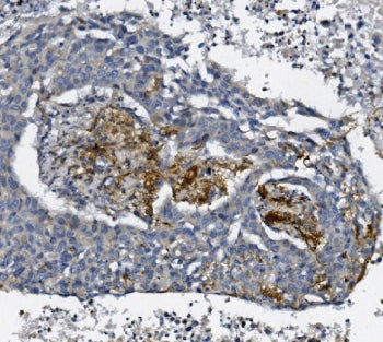 AFAP1 Antibody