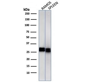 Western blot Anaysis of human 1) Ramos and 2) spleen cell Lyste using HLA-DRB1 antibody (clone HLA-D