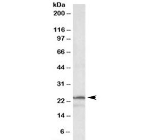 PSMB3 Antibody