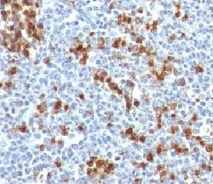 Kappa Light Chain Antibody