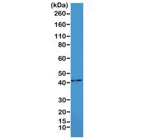 Alpha Actin Antibody / ACTA2 (smooth muscle)