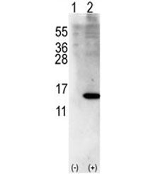 Western blot analysis of ISG15 antibody and 293 cell lysate (2 ug/lane) either nontransfected (Lane 