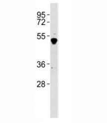 Western blot testing of GATA2 antibody at 1:2000 dilution + K562 lysate. Predicted molecular weight 
