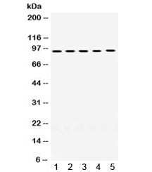 MCM8 Antibody