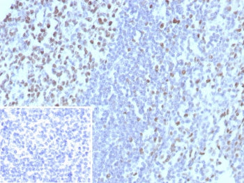 IHC staining of FFPE human tonsil tissue with MCM3 antibody (clone MCM3/8972R). Inset: PBS used in p