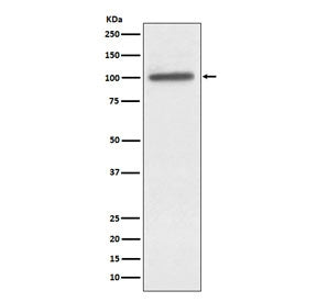 Western blot testing of human A431 cell lysate with ACTN4 antibody. Predicted molecular weight ~105 