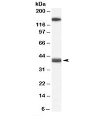 GALR1 Antibody