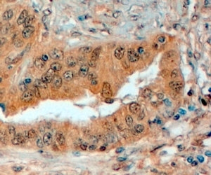 Semaphorin 3E Antibody