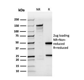 SDS-PAGE analysis of purified, BSA-free recombinant BrdU antibody (clone rBRD494) as confirmation of