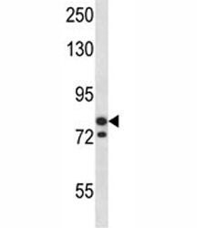 MCM3 Antibody