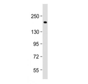 Western blot testing of Thrombospondin 1 antibody at 1:2000 + human MDA-MB-231 cell lysate. Expected