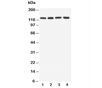 Western blot testing of TLR7 antibody and lysate from lane 1: rat spleen; 2: rat liver; 3: human U87