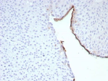 Uroplakin 3B Antibody / UPK3B