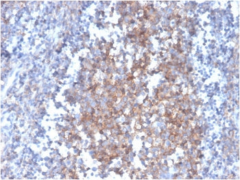 IHC staining of FFPE human tonsil with Fas Ligand antibody (clone FASLG/4455). HIER: boil tissue sec
