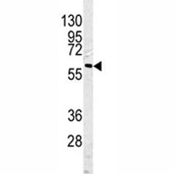 Caspase-10 Antibody