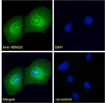 Immunofluorescent staining of human U-2 OS cells with RBM20 antibody (green) at 10ug/ml and DAPI nuc