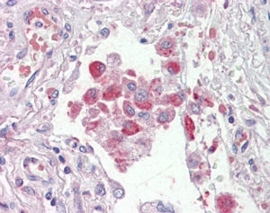 OSBPL9 Antibody