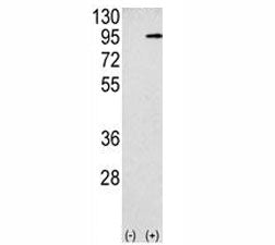 Western blot analysis APP antibody and 293 cell lysate (2 ug/lane) either nontransfected (Lane 1) or